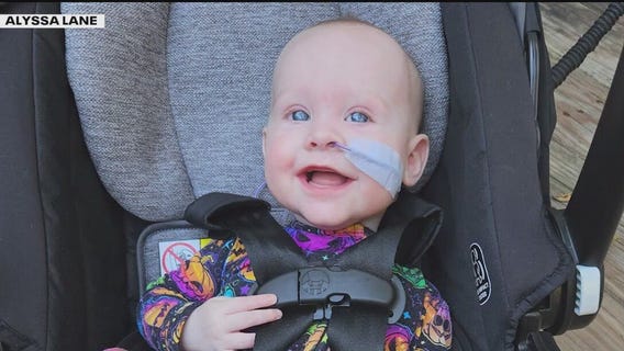 New treatment provides hope for infant with rare disease