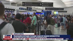 What is Monkeypox? What are Monkeypox symptoms? WaPo reporter answers questions about a rare disease