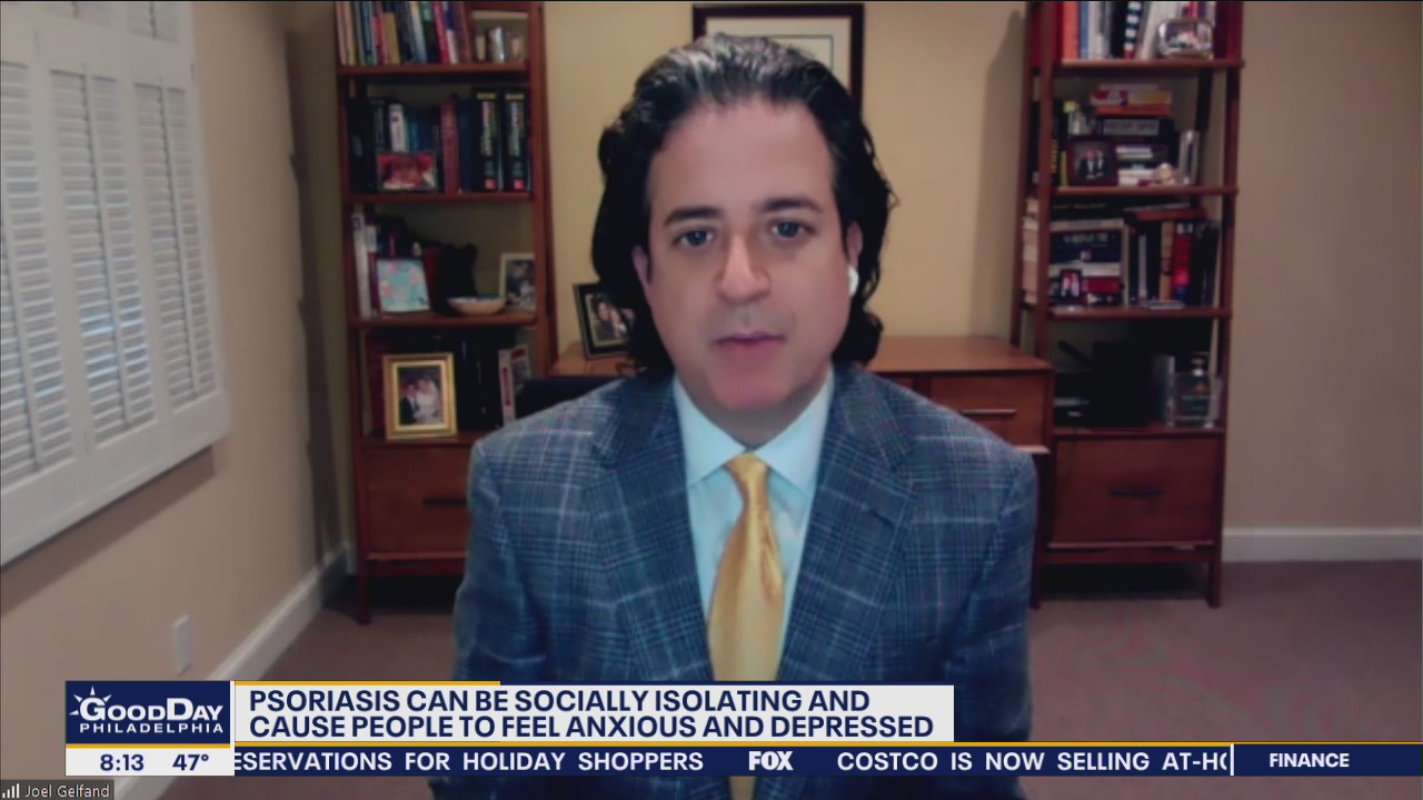 Doctor discusses the mental impact of psoriasis