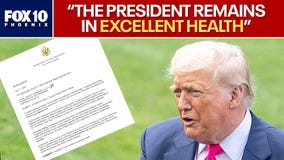 Trump diagnosed with chronic venous insufficiency