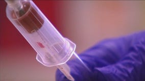 Doctors sound alarm after increase of alcoholic fatty liver disease cases