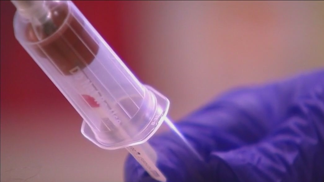 Doctors sound alarm after increase of alcoholic fatty liver disease cases