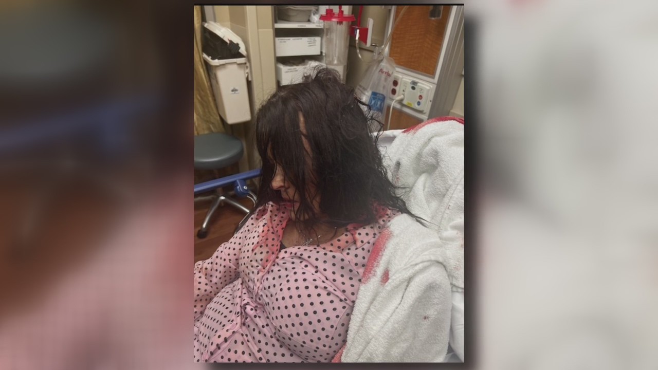 Restaurant manager beaten up by angry customer in Livonia