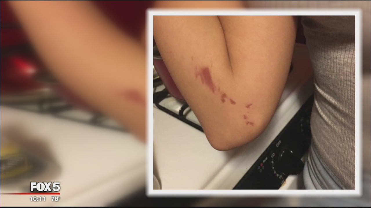 Mother says justice system going easy on daughter's attackers in Prince George's County park beating