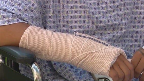 Doctors urge firework safety ahead of Fourth of July