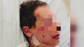 Man recounts brutal attack in his Studio city driveway, suspect still wanted