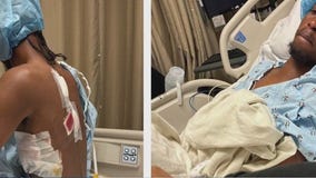 Teen attacked by group at LA County beach