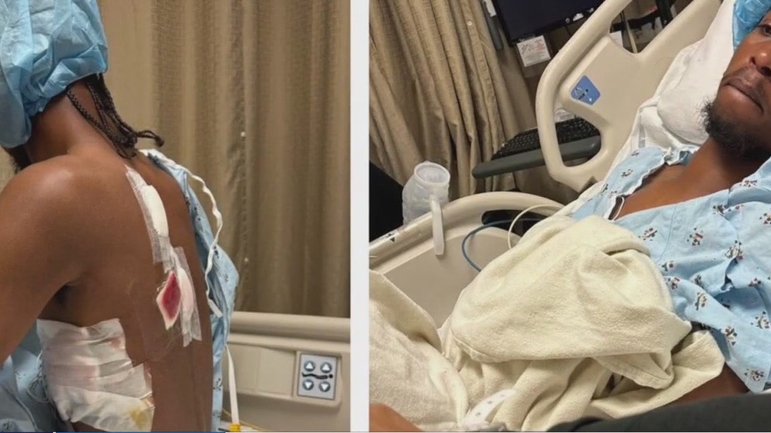 Teen attacked by group at LA County beach