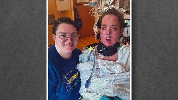 Open Record: Brain Trust