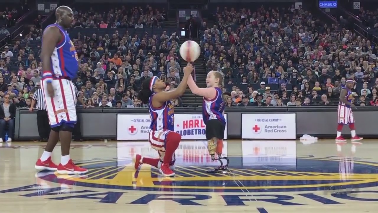 BAY AREA PEOPLE 10-Year-Old Amputee Bounces Back