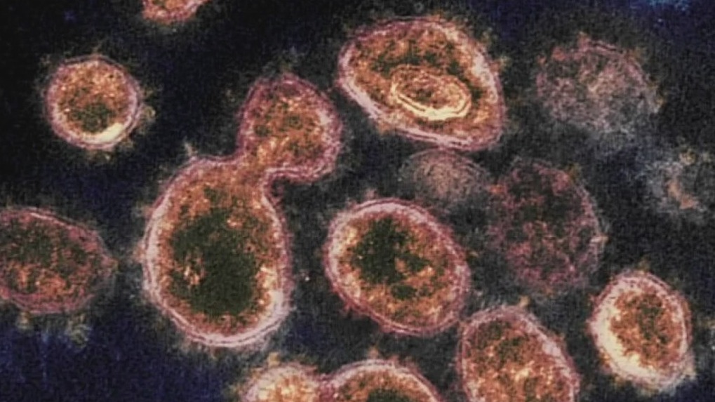 Delta variant dominant strain of COVID-19