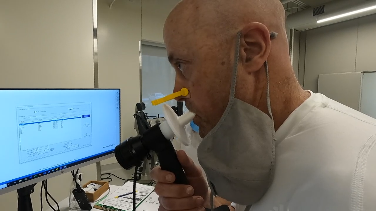 Man who was Milwaukee County's 1st COVID case part of MU long haul study