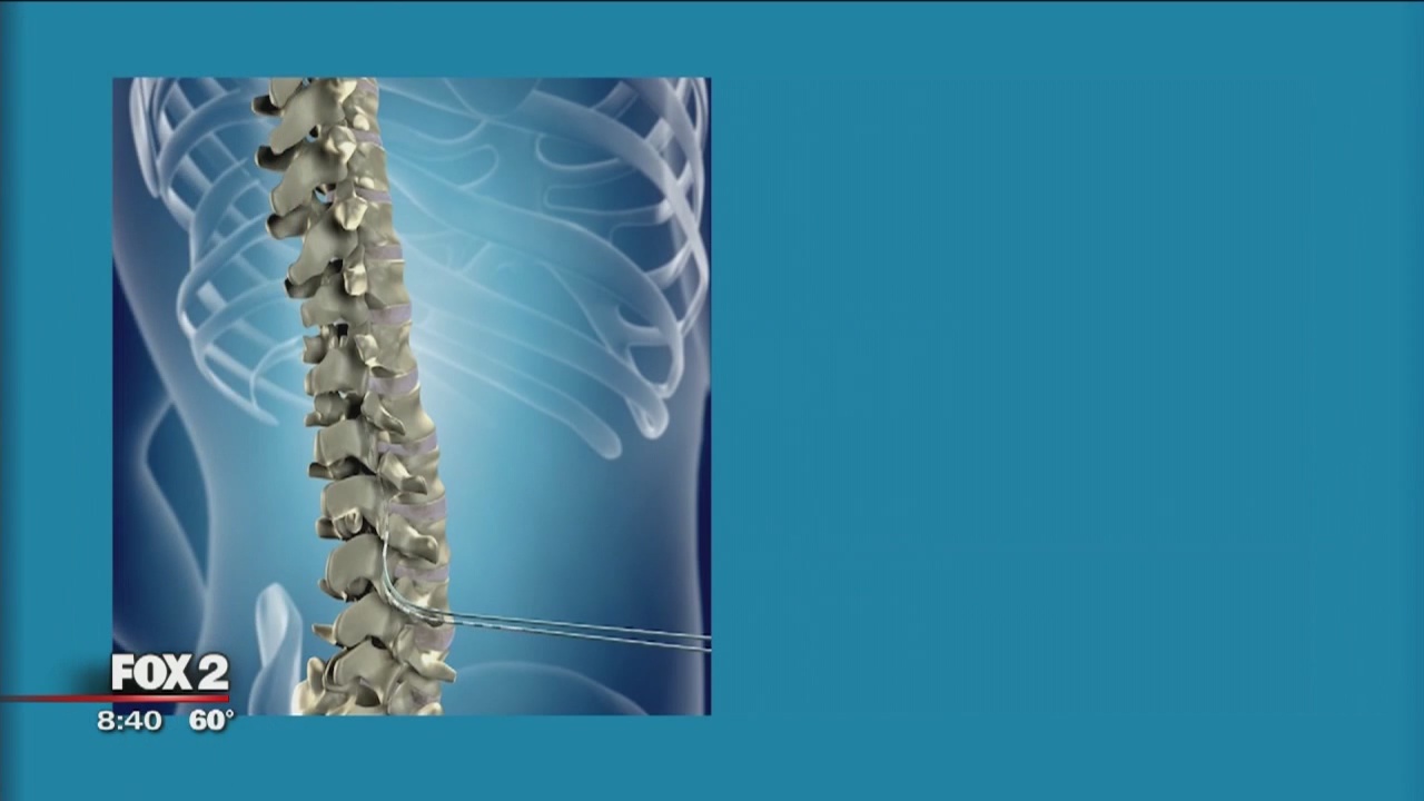 The Doctor Is In: Managing Chronic Pain