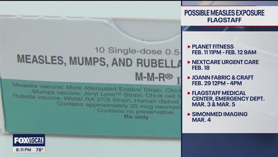 Measles case reported in Coconino County