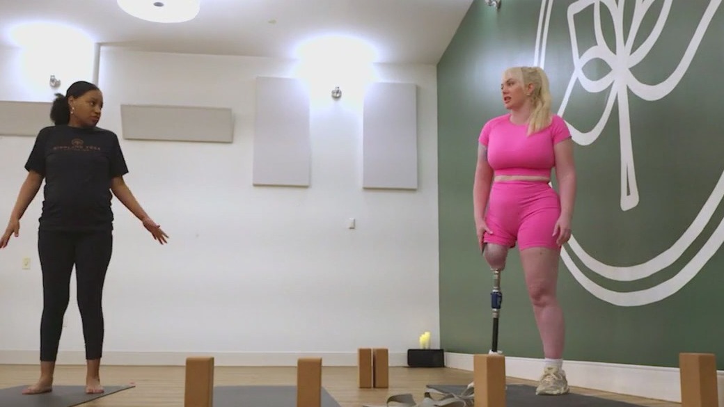 Amputee turns to yoga after using leg