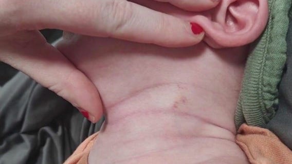 Child abuse recognition is the focus of new bill