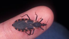 CDC declares 'kissing bug disease' endemic
