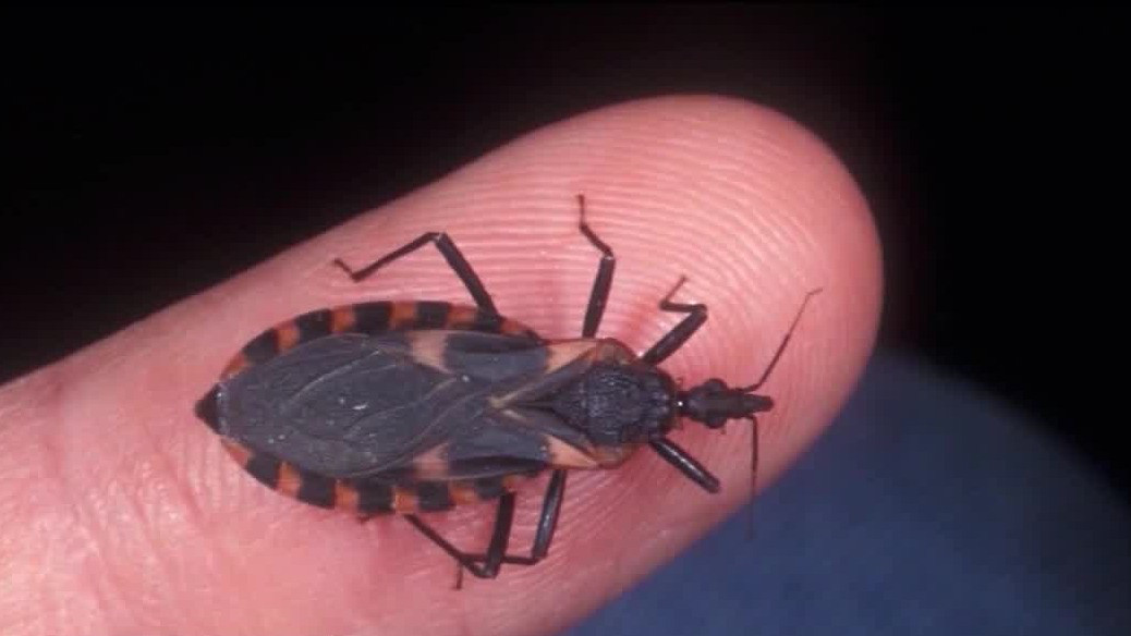 CDC declares 'kissing bug disease' endemic