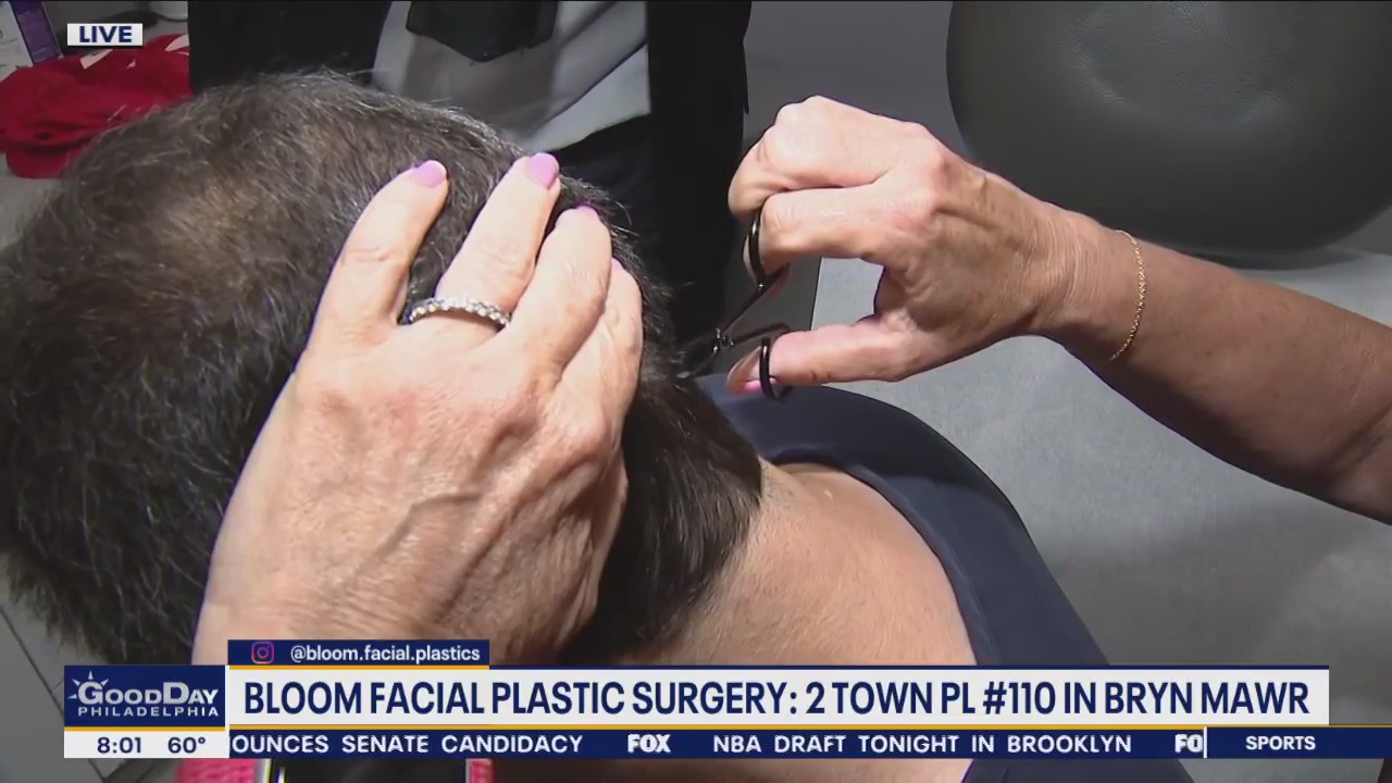 Local doctors provide hair loss services through follicle preservation