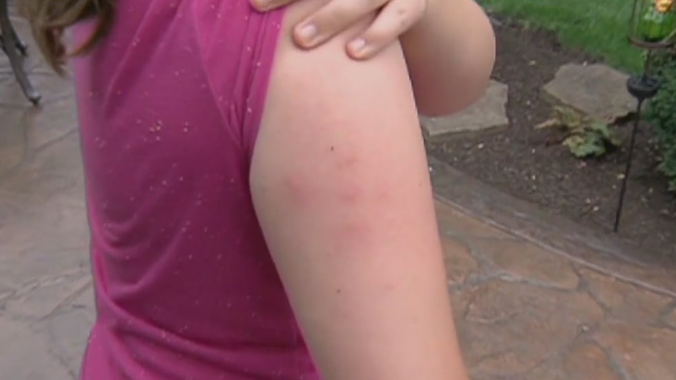 Mosquitoes may be attracted to your scent