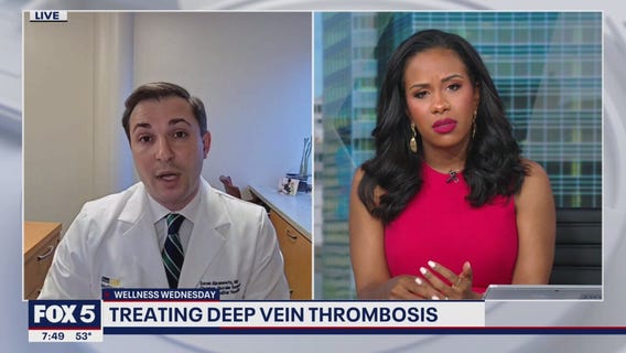 Treatment options for by Deep Vein Thrombosis