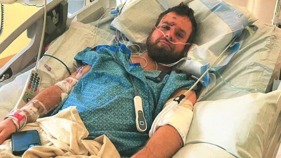 Metro Transit settles lawsuit with skateboarder for state max