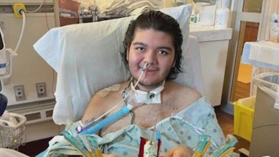 Field Museum makes double-lung re-transplant recipient an 'honorary paleontologist'