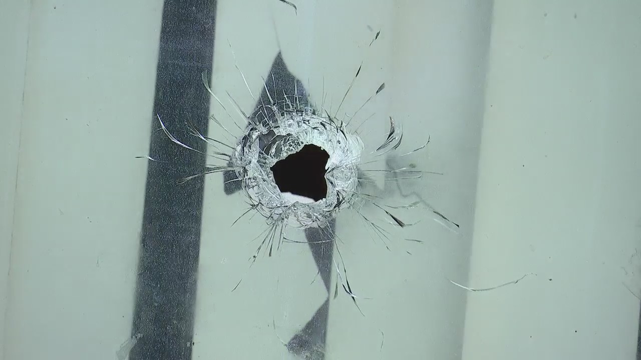 8-year-old escapes drive-by shooting with only stitches | FOX 2 Detroit