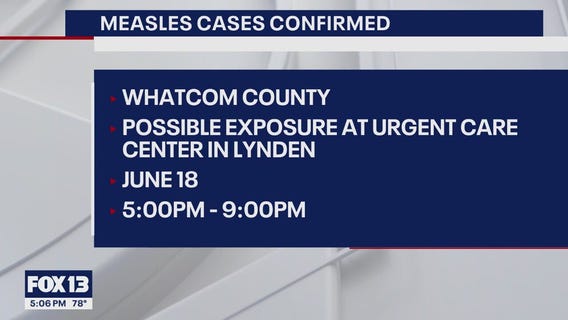 2 measles cases confirmed in Whatcom County