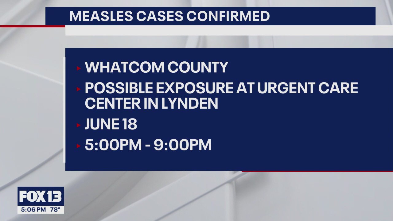 2 measles cases confirmed in Whatcom County