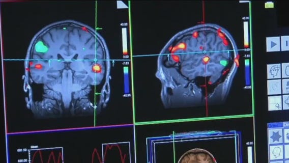 Scientists announce possible breakthrough in delaying Alzheimer's