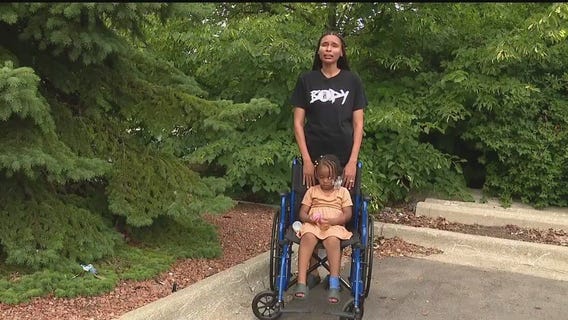 3-year-old hospitalized with severe burns in Detroit