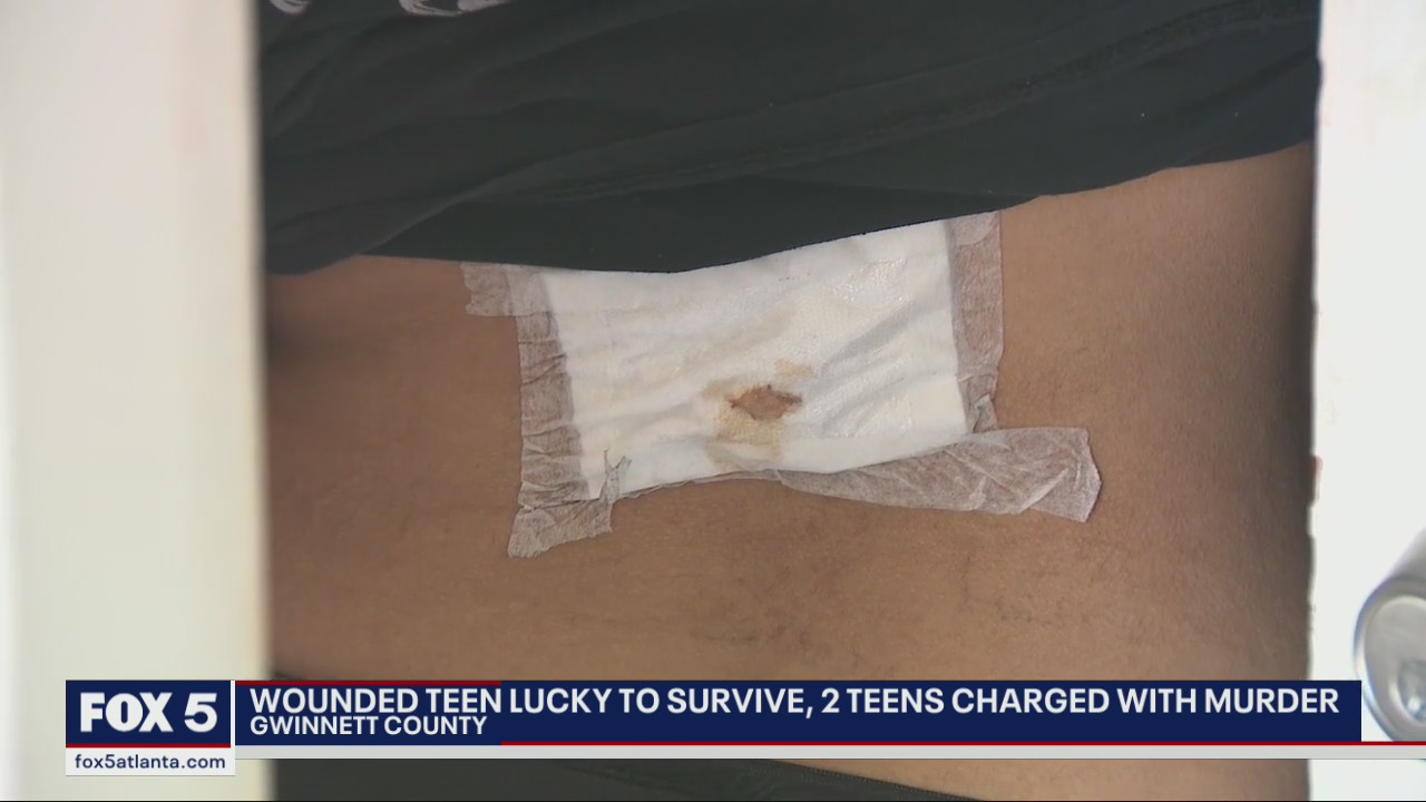 Gwinnett County teen shot in the back feels lucky to be alive | FOX 5 ...