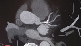 Chicago medical duo operating first-of-its-kind clinic for cardiac care