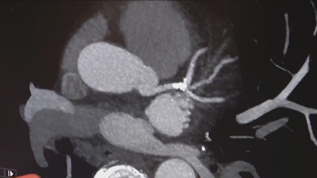 Chicago medical duo operating first-of-its-kind clinic for cardiac care