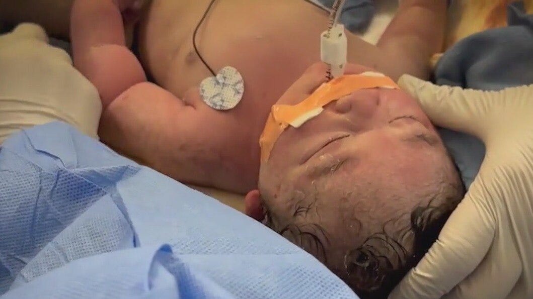 Healthy baby boy born after growing outside of uterus