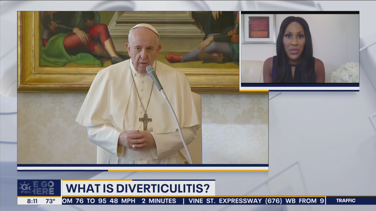 What is diverticulitis? Pope recovering after colon surgery