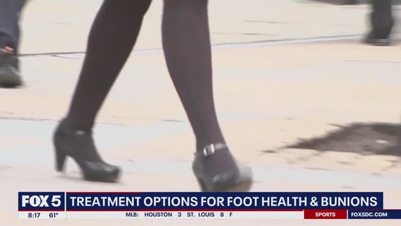 Foot health advice on bunion treatment and options