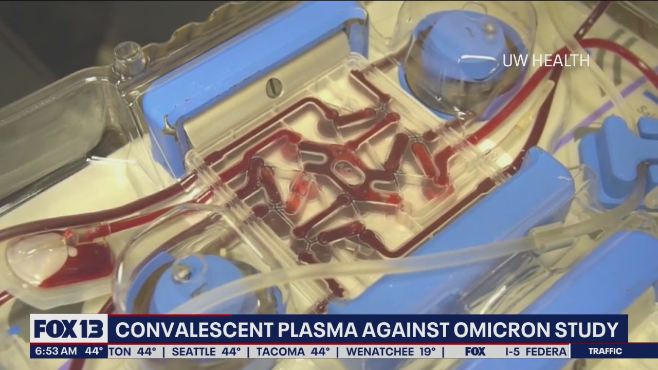 Study on convalescent plasma could reduce omicron variant hospitalizations