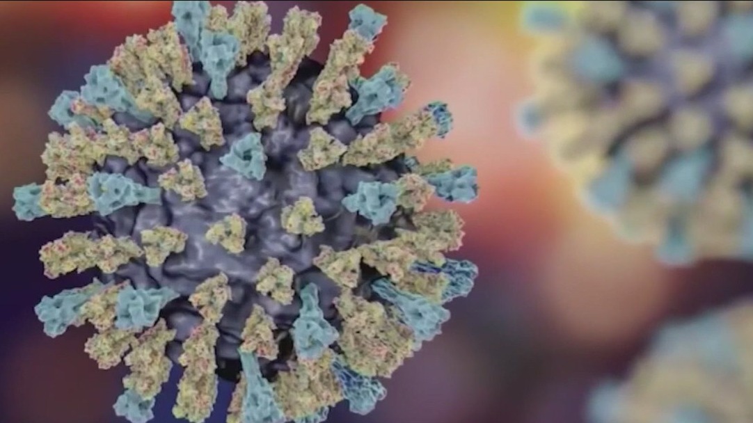 More measles cases confirmed in U.S. states