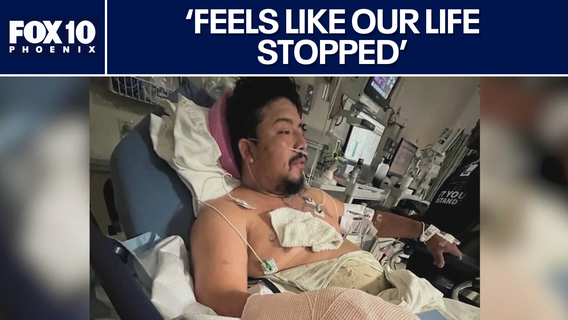 Valley Fever case forces Phoenix man's arm amputation