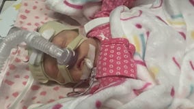 Father loses job as baby fights for life