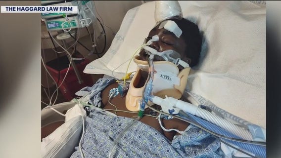 Woman shot in head, sues Tampa apartment complex