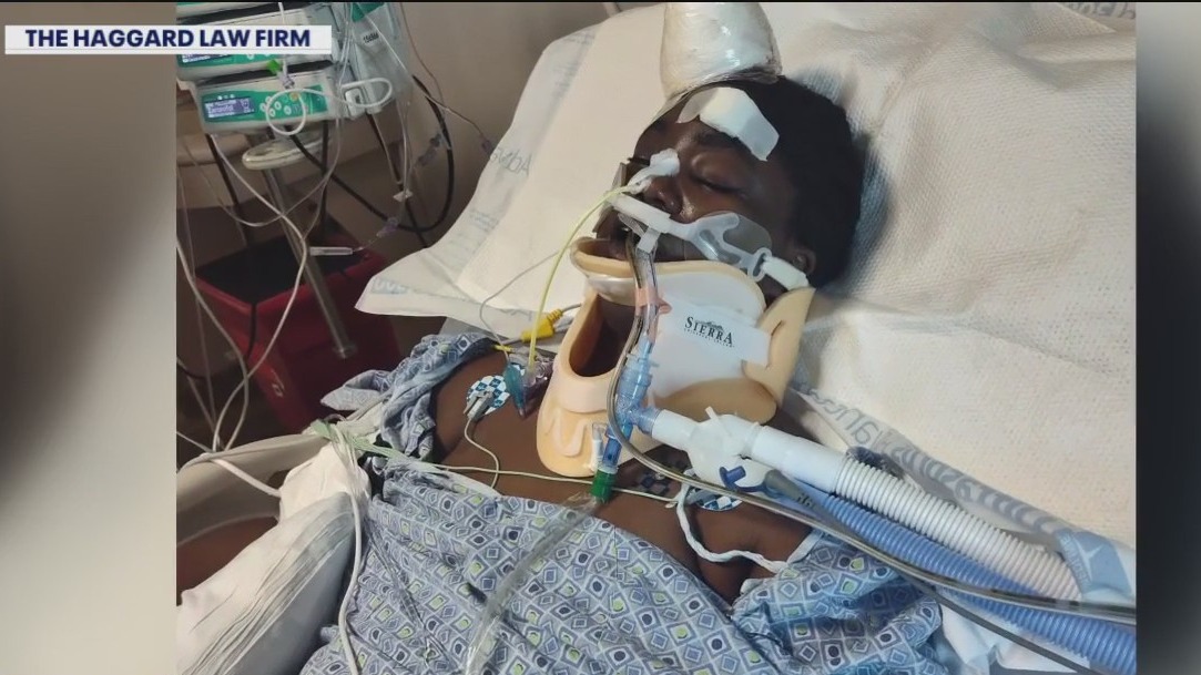 Woman shot in head, sues Tampa apartment complex