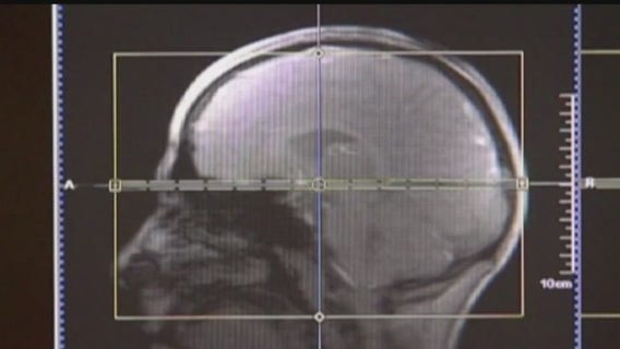 Metro Detroit experts on mental condition of NYC mass shooter