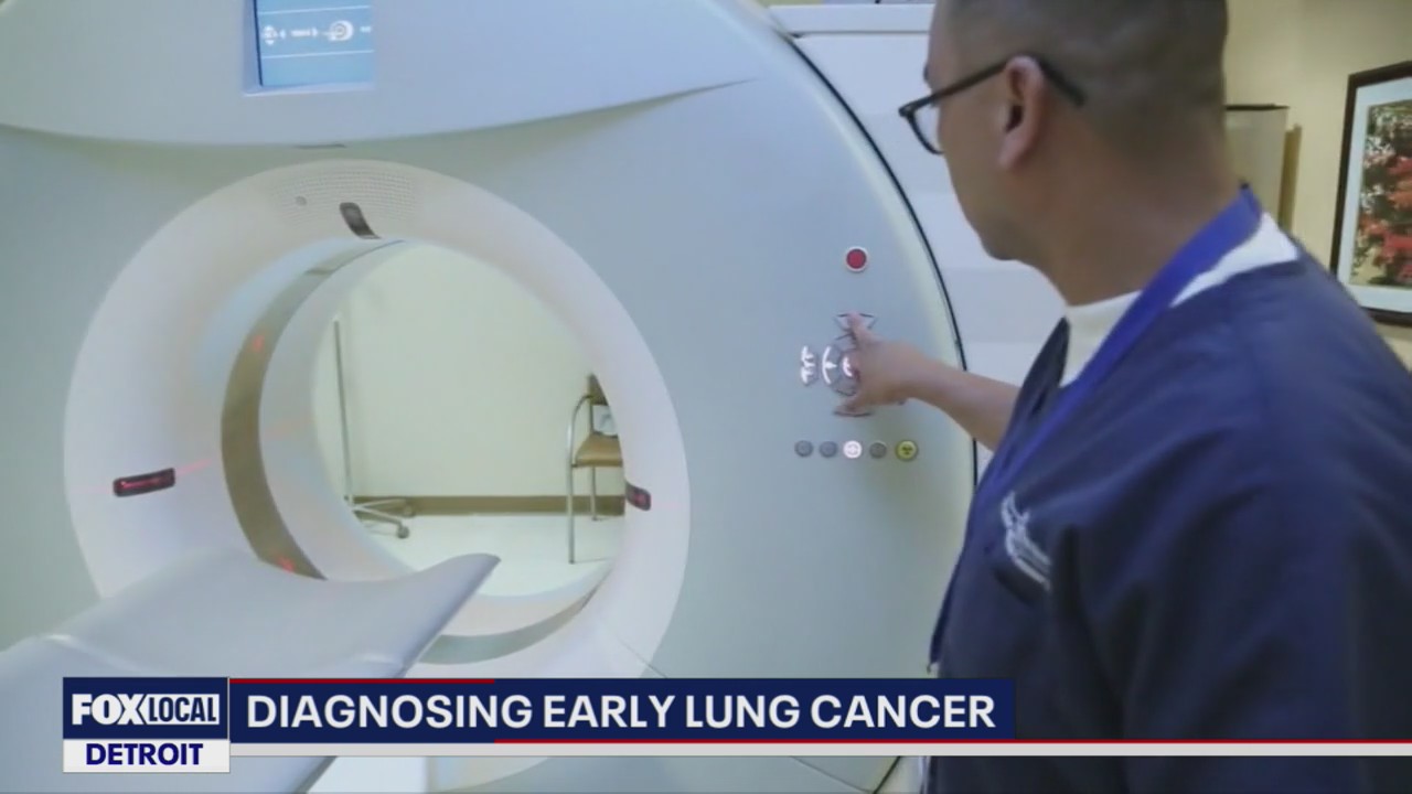 Low-dose CT scan detects lung cancer early