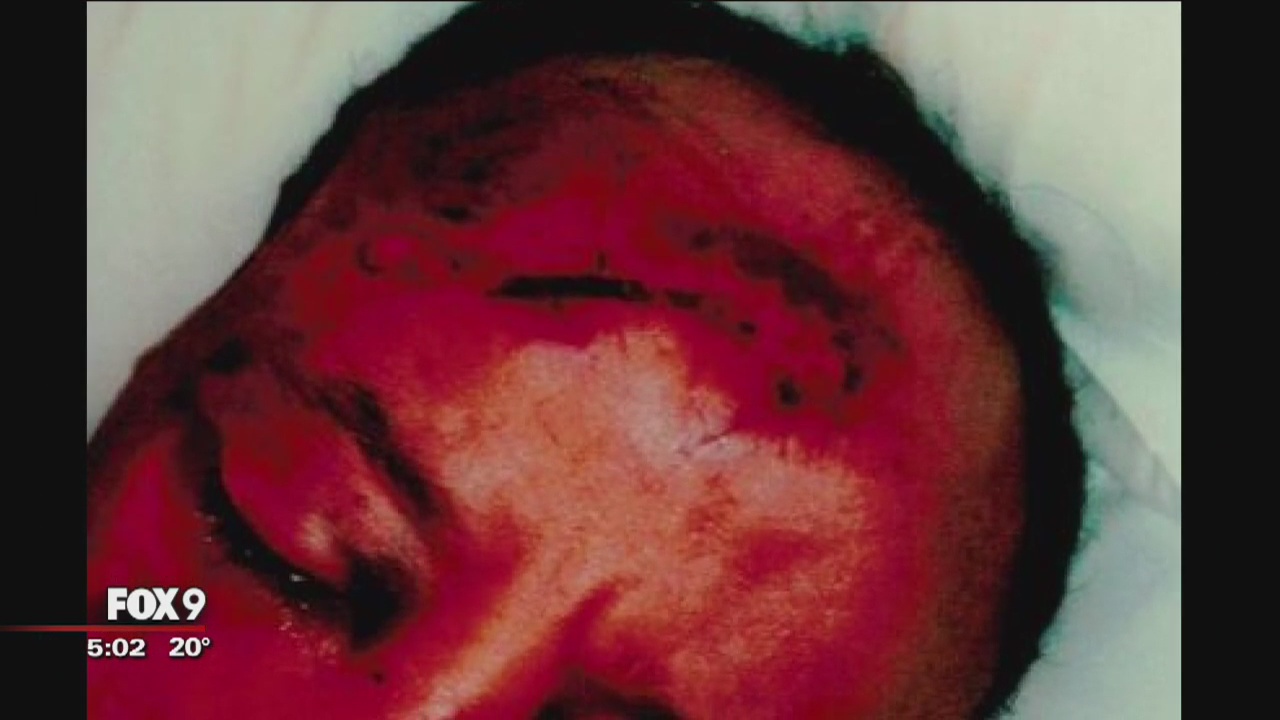 Former Minneapolis police officer sentenced to workhouse after on-duty assault