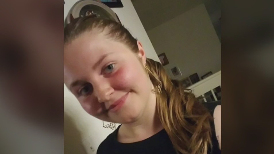 Teen suffers seizures, extremely rare brain clots after Johnson & Johnson vaccine