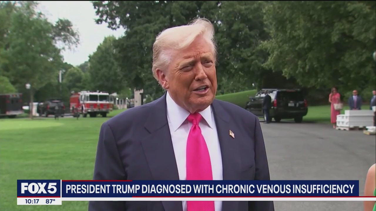 Doctor explains Pres. Trump's vein condition diagnosis