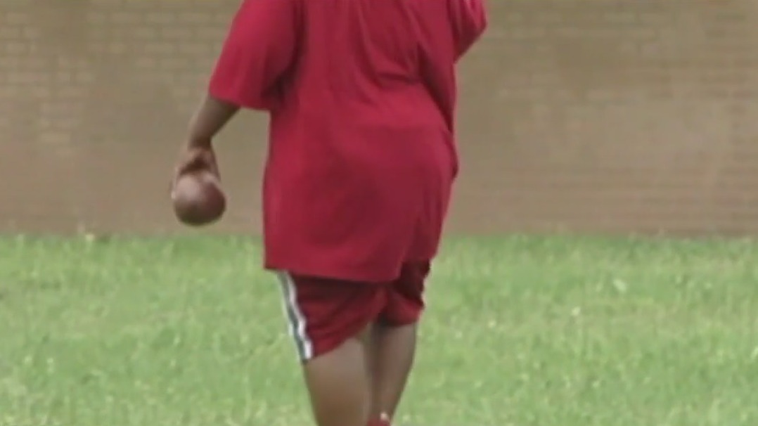 Obesity comes under the microscope after latest CDC data